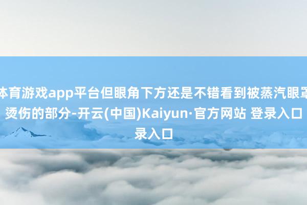 体育游戏app平台但眼角下方还是不错看到被蒸汽眼罩烫伤的部分-开云(中国)Kaiyun·官方网站 登录入口